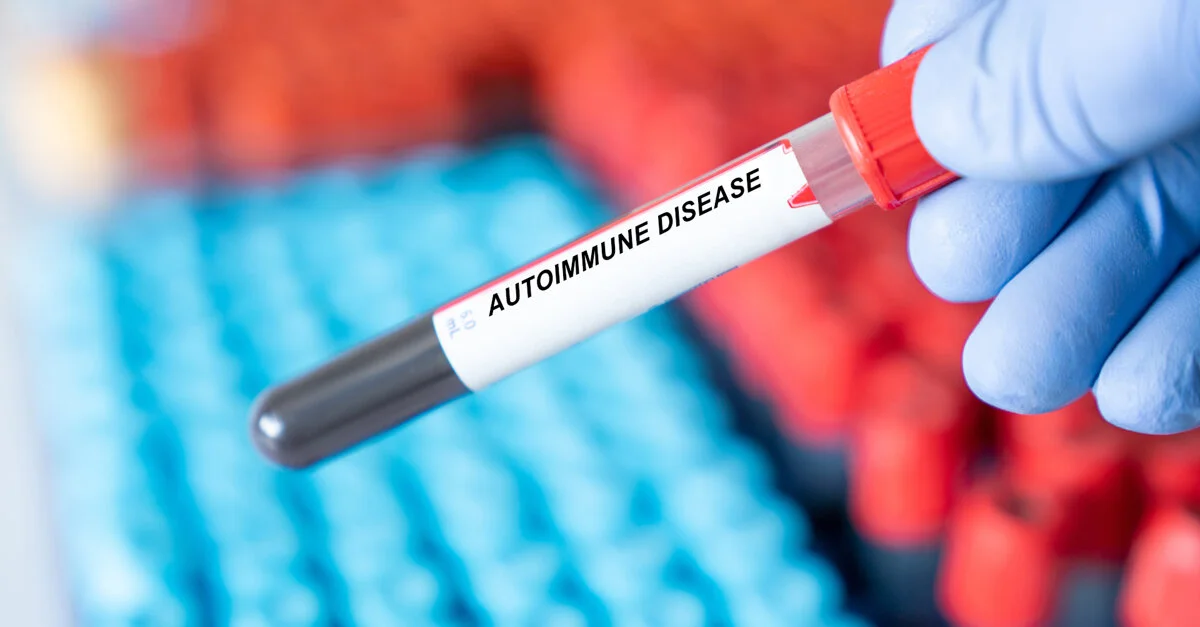 Study Links Periodontal Disease to Autoimmune Conditions and Higher Mortality Risk